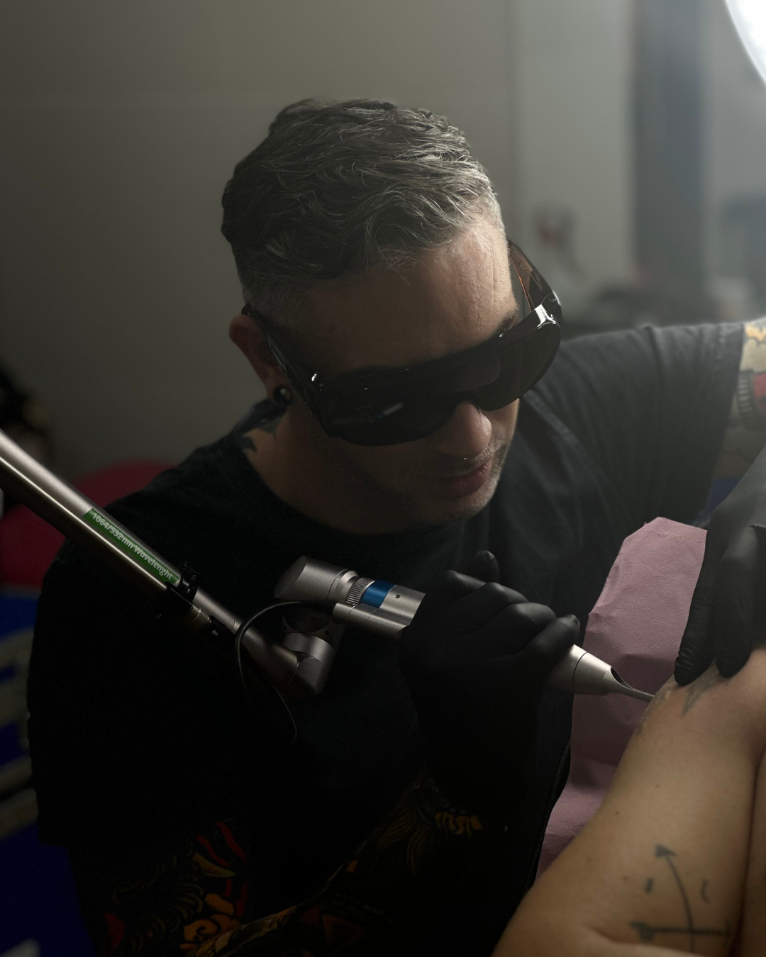 eliminación de tatuajes en Sitges